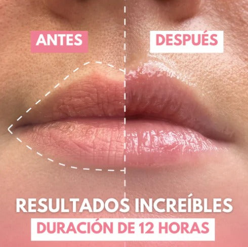 ¡Labios Voluminosos al Instante! 🌞✨ Oferta de Verano + Envío Gratis: ¡Transforma tu Sonrisa Hoy Mismo! 💋