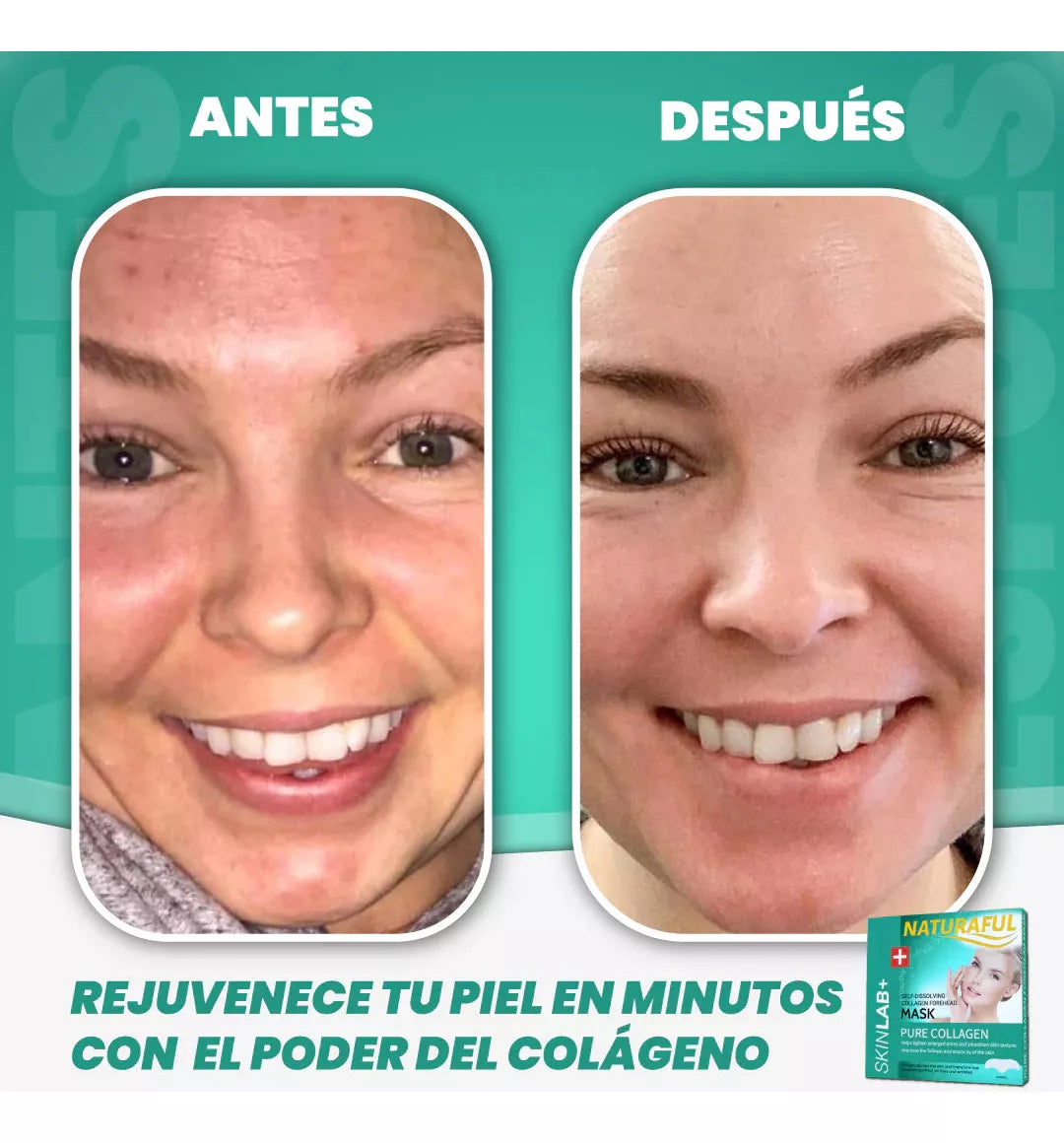 🔥¡Parches De Colageno Absorventes!👸🏼 ¡Oferta Con Envio Gratis!🚚📦 ¡Oferta Imperdible Para Que Luzcas Radiante!🥰